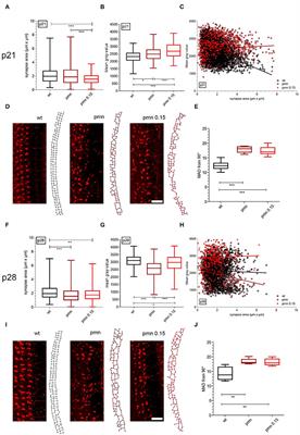 Pegylated Insulin-Like Growth Factor 1 attenuates Hair Cell Loss and promotes Presynaptic Maintenance of Medial Olivocochlear Cholinergic Fibers in the Cochlea of the Progressive Motor Neuropathy Mouse